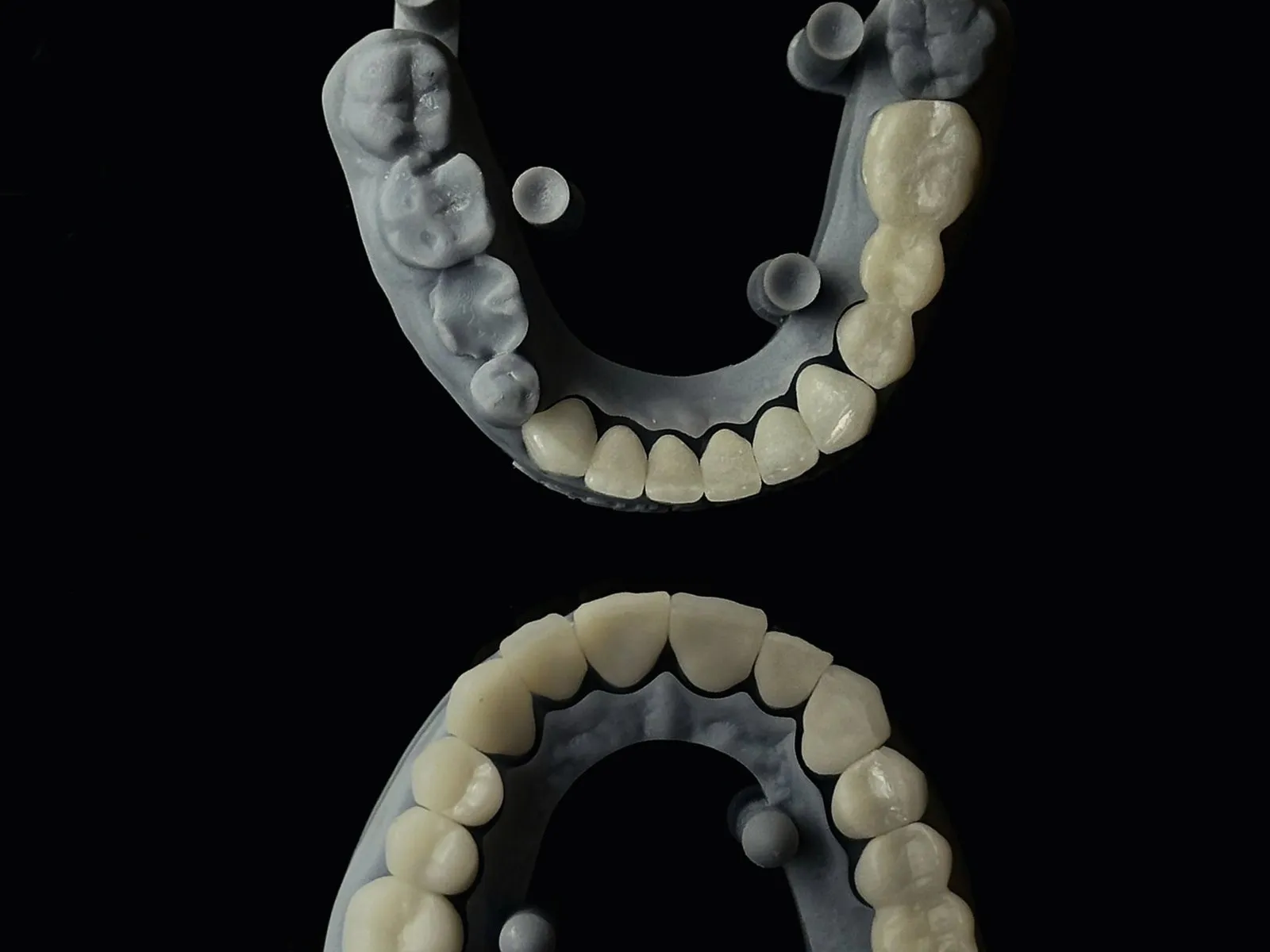 Digital model of a dental arch