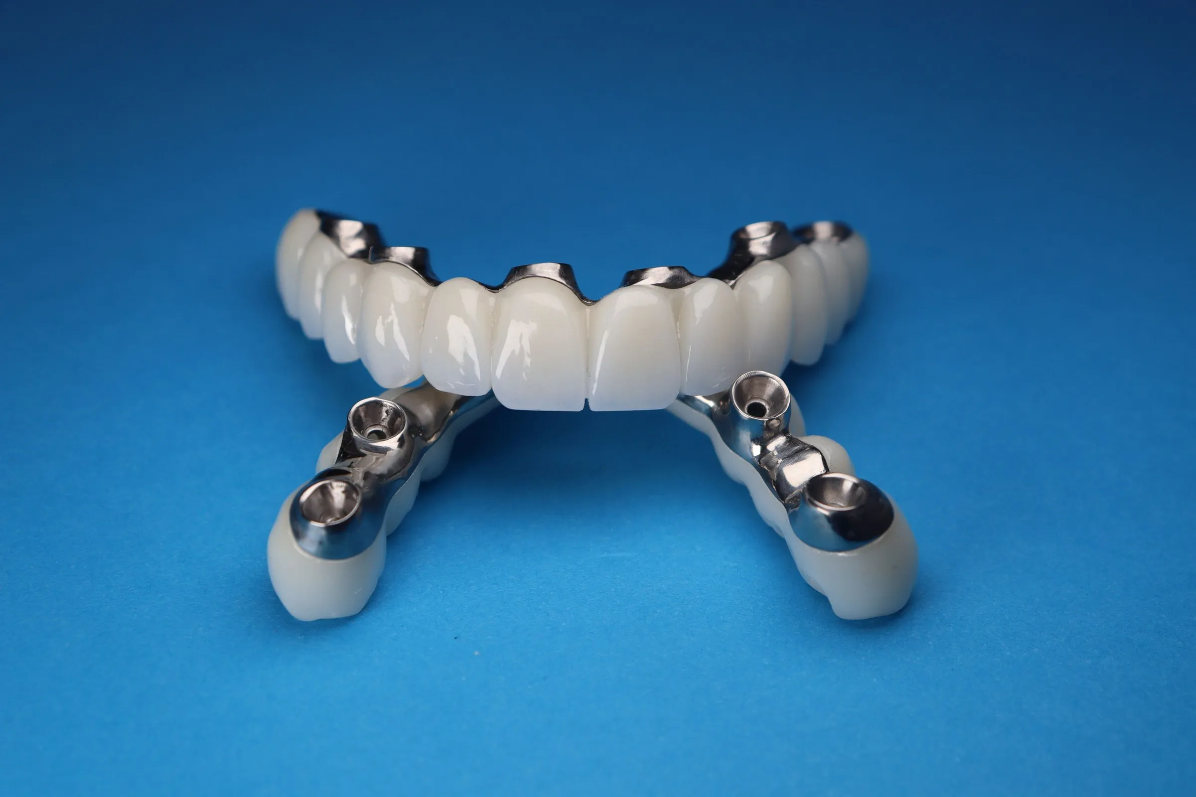 All-on-4 İmplant — MSG Dent