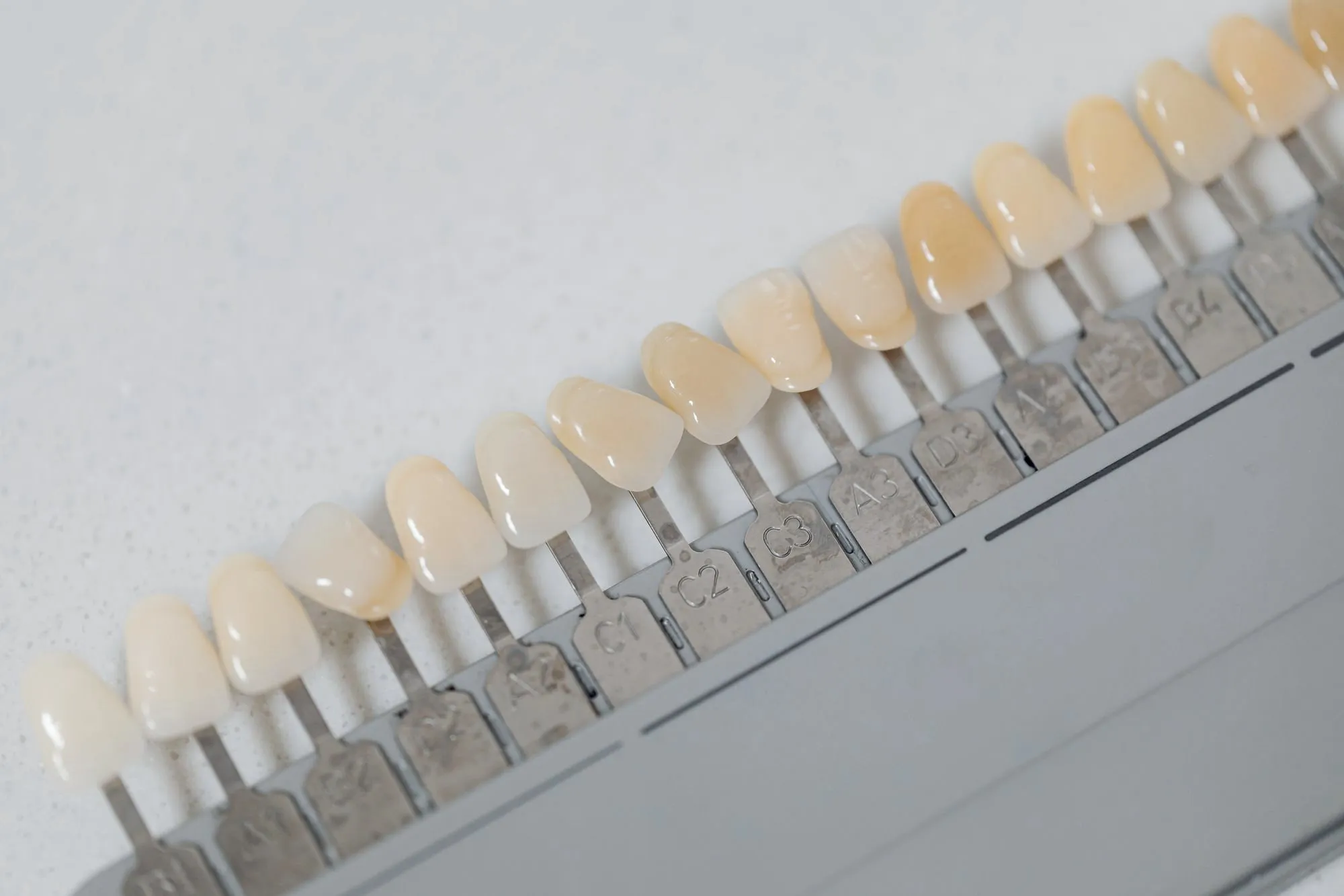 Gülüş Tasarımı — MSG Dent